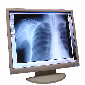 Monitor DNS-Tech MS19DC-W, LCD, 19 inch, 1280 x 1024, DVI, 16.7 milioane de culori